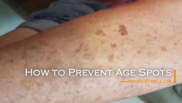 How To Prevent Age Spots And Remove Them Modest Pie